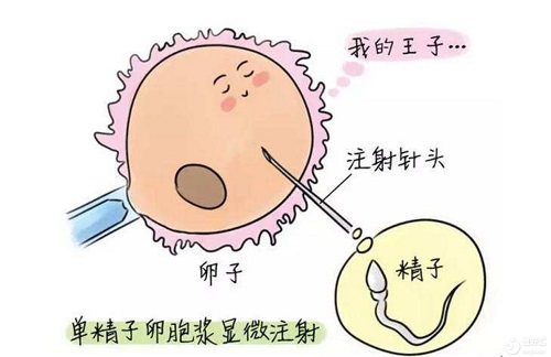試管嬰兒費用總共多少？三代試管費用會增加嗎？