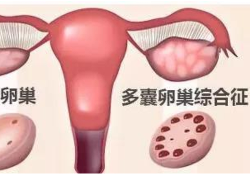 試管嬰兒可以生嗎？