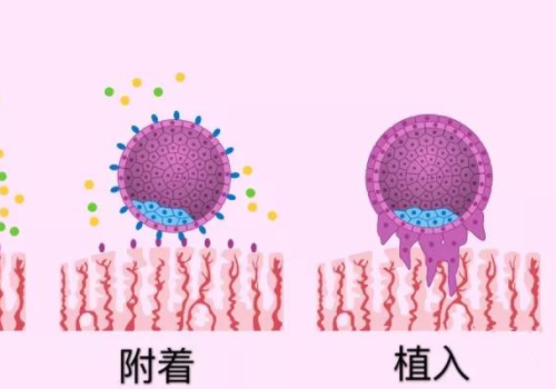 美國試管助孕技術解析？
