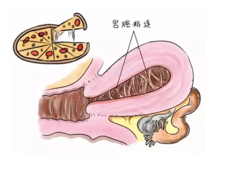 美國試管嬰兒費用及流程？