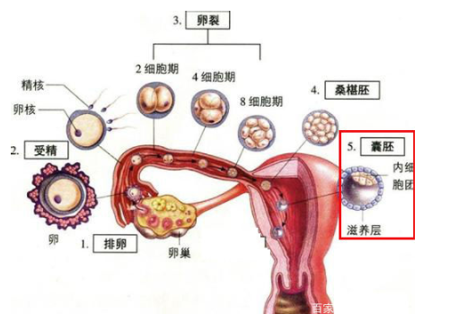 去泰國(guó)做試管準(zhǔn)備什么？